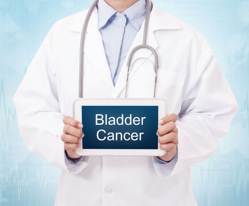 BLADDER CANCER 