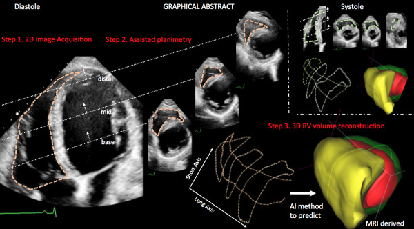 Λογισμικό Ελλήνων επιστημόνων ανιχνεύει καρδιακά προβλήματα