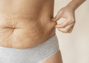 Σαρκοπενία: Ο ρόλος των ενέσεων απώλειας βάρους