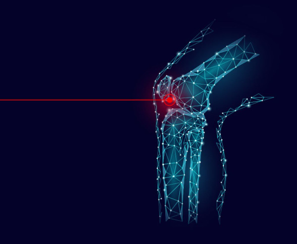 Πόνος στο γόνατο: Πότε απαιτείται η αρθροπλαστική