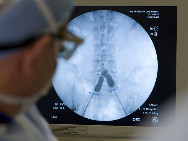 Πώς ένα μεταλλικό κομμάτι, παρατημένο στο πάτωμα από έναν μάστορα, «γέννησε» το σωτήριο στεντ