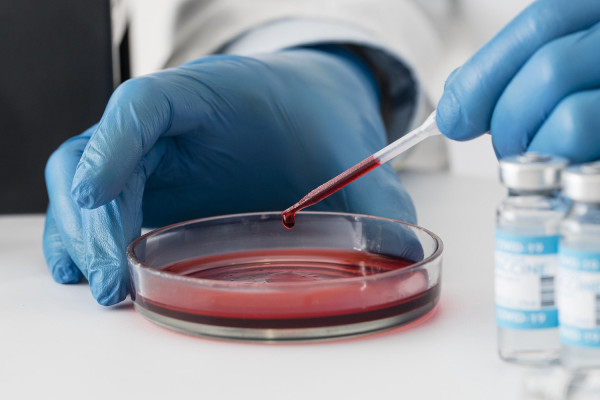 FDA: Έγκριση νέου φαρμάκου για σπάνιο και επιθετικό καρκίνο του αίματος
