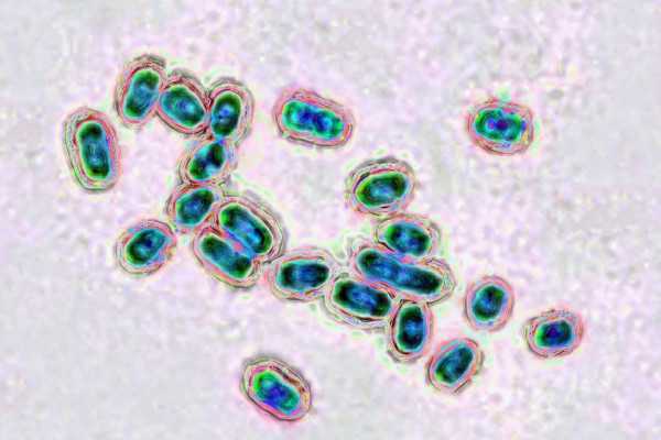 Τι είναι ο πνευμονιόκοκκος και ποιοι κινδυνεύουν - Οι επιπλοκές