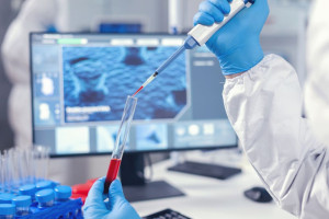 ΕΟΠΕ: «Καθυστέρηση στην εφαρμογή του νέου πλαισίου για τους βιοδείκτες» - Η συμβολή της φαρμακοβιομηχανίας