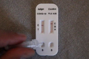 Θεμιστοκλέους: Δεν χρειάζεται πανικός για τη γρίπη - Το ΕΣΥ είναι προετοιμασμένο