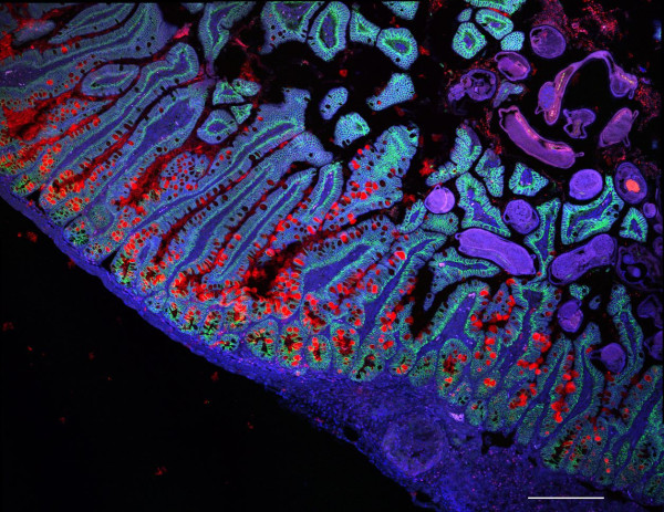 Αποτύπωση του λεπτού εντέρου. Credit: Grace Burgin, Noga Rogel &amp; Moshe Biton, Klarman Cell Observatory, Broad Institute